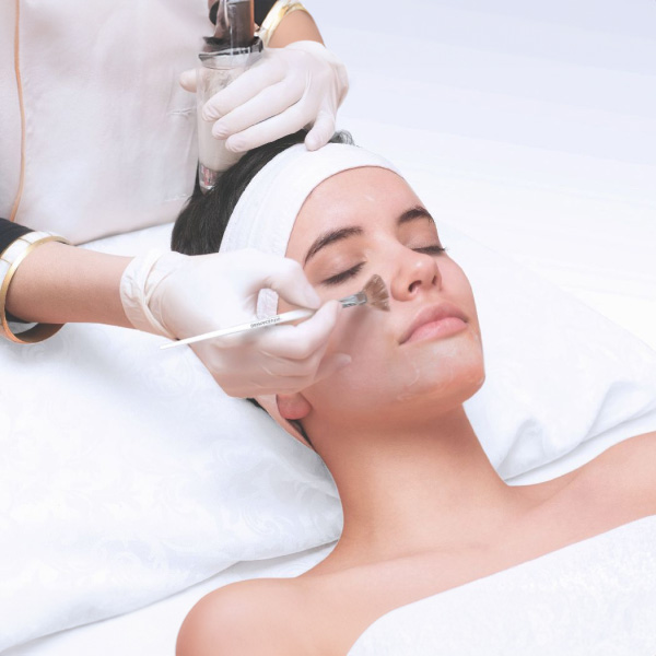 Chemical Peels